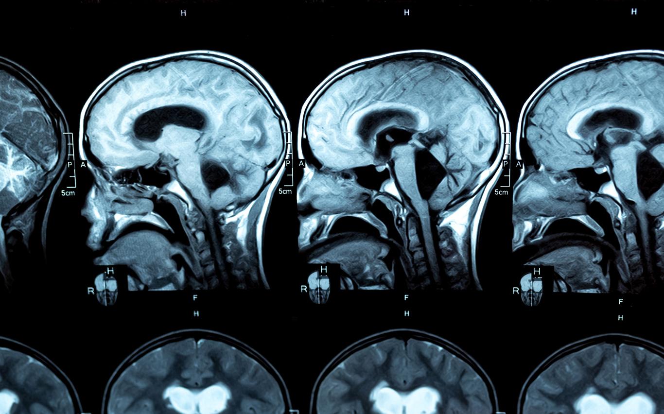 Magnetic resonance imaging