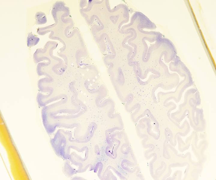 A thin section of a brain on a glass plate