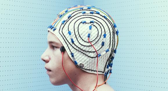 Patient wearing an electrode cap