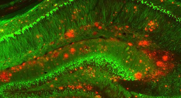 A close-up of a mouse brain used in Strittmatter’s research on Alzheimer’s disease